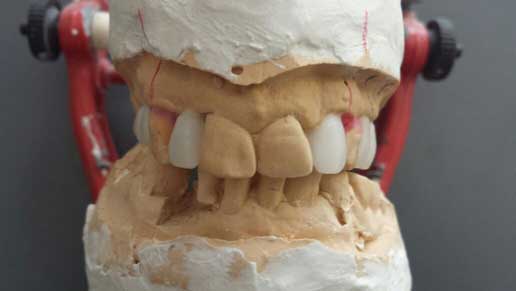 ortodonzia-adulti3