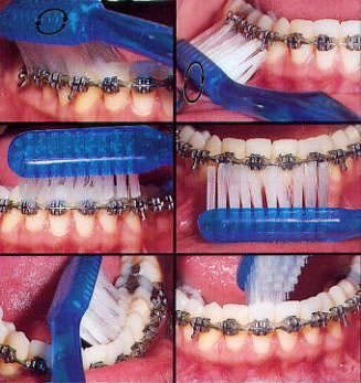 ortodonzia napoli caserta1
