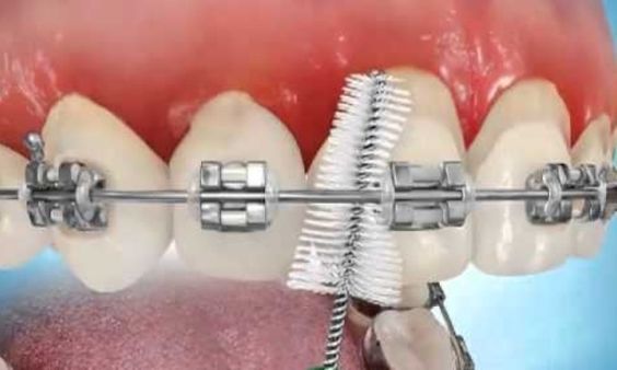 ortodonzia napoli caserta2